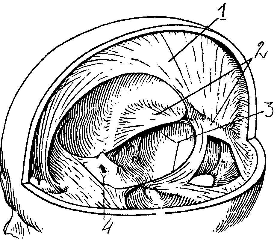 Твердая мозговая оболочка намет мозжечка. Серп большого мозга и намет мозжечка. Серп большого мозга серп мозжечка. Серп большого мозга (твёрдая мозговая оболочка). Диафрагма черепа