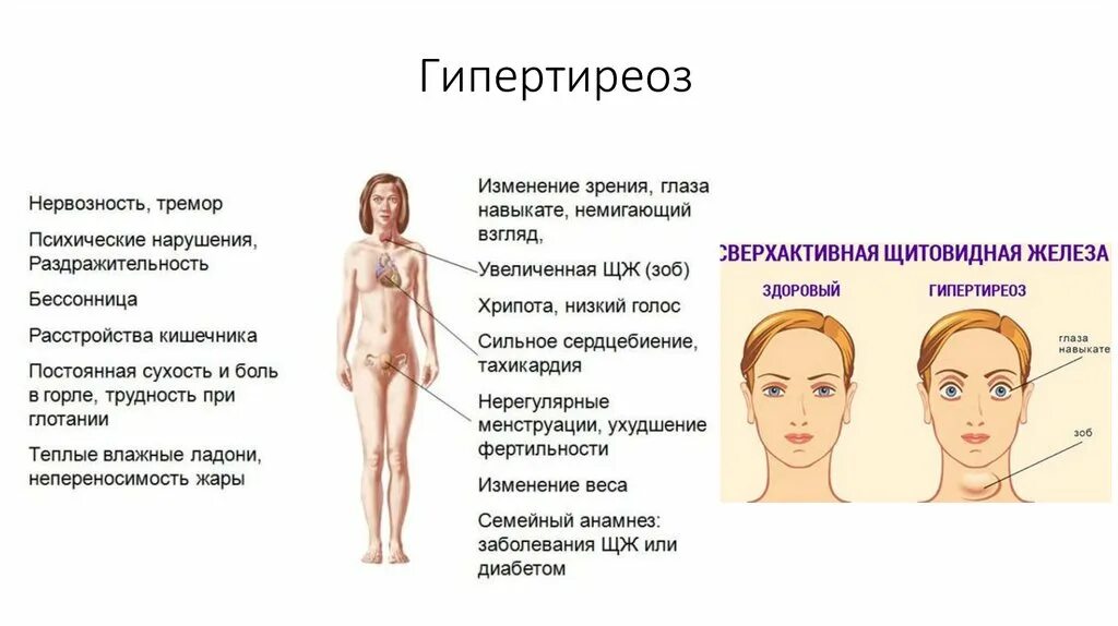 Щитовидная железа симптомы у мужчин внешние признаки. Клинические симптомы гипертиреоза. Клиническая картина гипертиреоза. Гипертиреоз пищеварение.