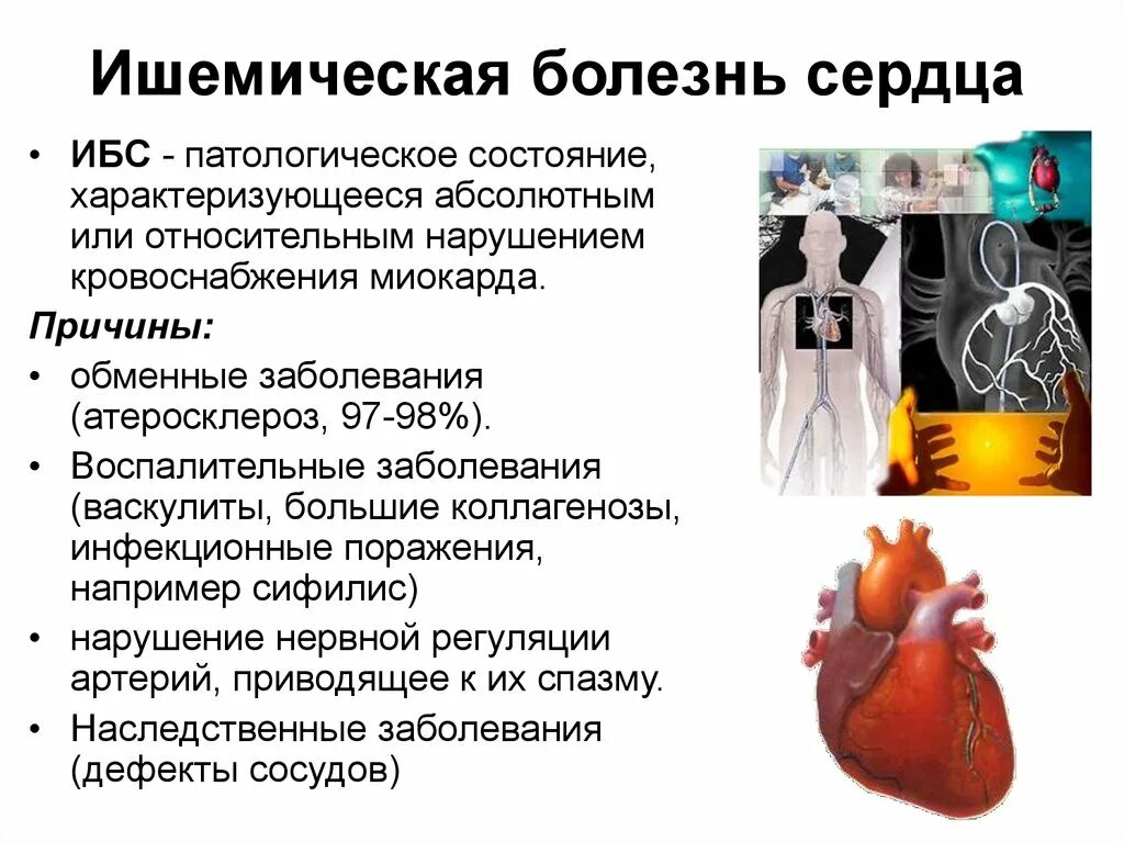 Какие симптомы ишемии