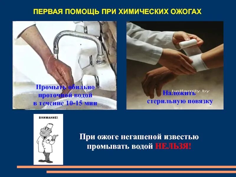 Оказание первой мед помощи при химических ожогах. Алгоритм оказания первой медицинской помощи при химических ожогах. Помощь при химических ожогах кратко. Помощь при химических ожогах кратко. Принципы оказания первой медицинской помощи при ожогах.