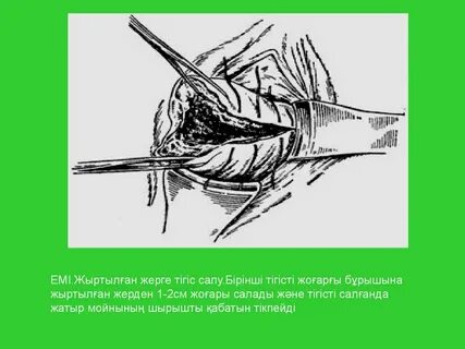 Секс құлдығы туралы бейне