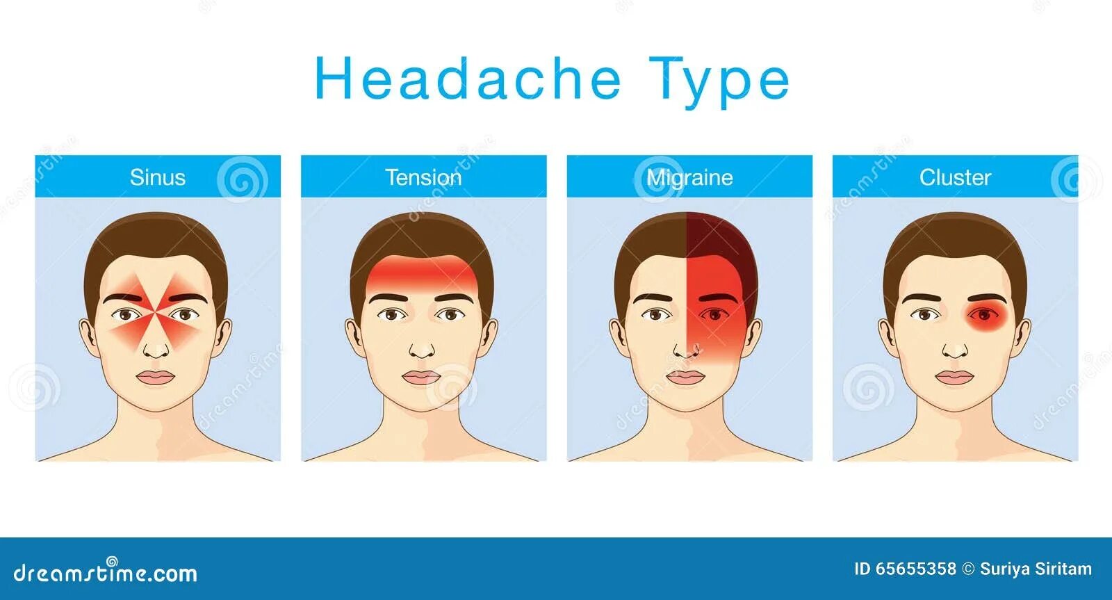 Головная боль переводчика. Виды головной боли. Types of headache. Мигрень. Головная боль иллюстрация.