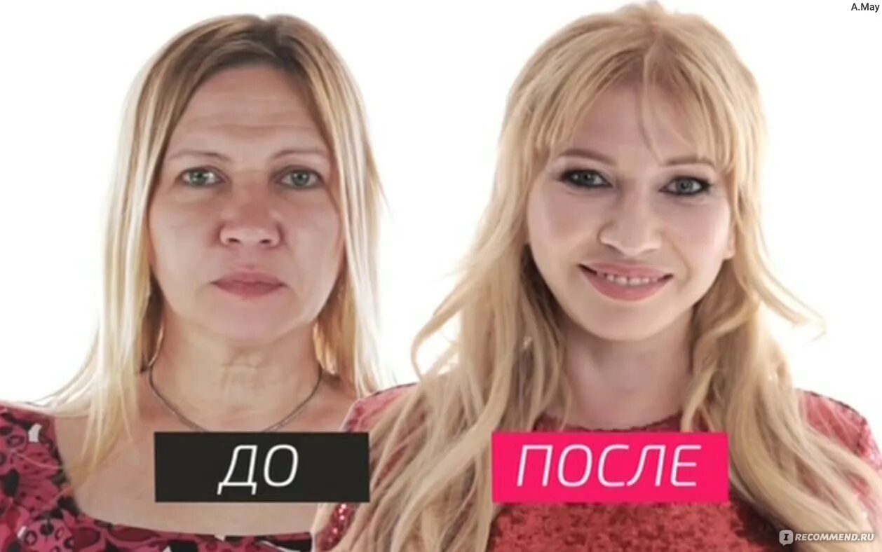 Татьяна иванова до и после пластики фото 33 года в "Комбинации": Как "два кусочека колбаски" стали кармой Золушки из Сара