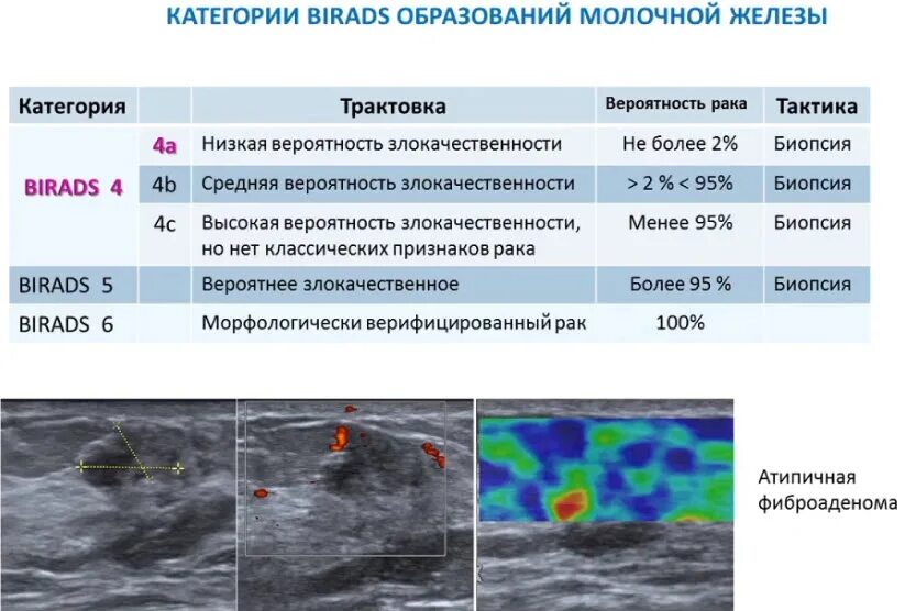 Категория bi rads 2 молочных желез