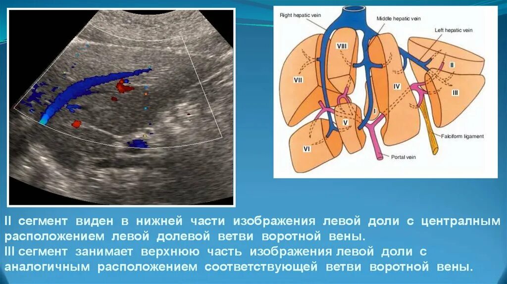 Сегменты печени. Воротная Вена печени сегменты. Сегментарные ветви воротной вены. Сегменты печени на УЗИ. Какая вена в печени