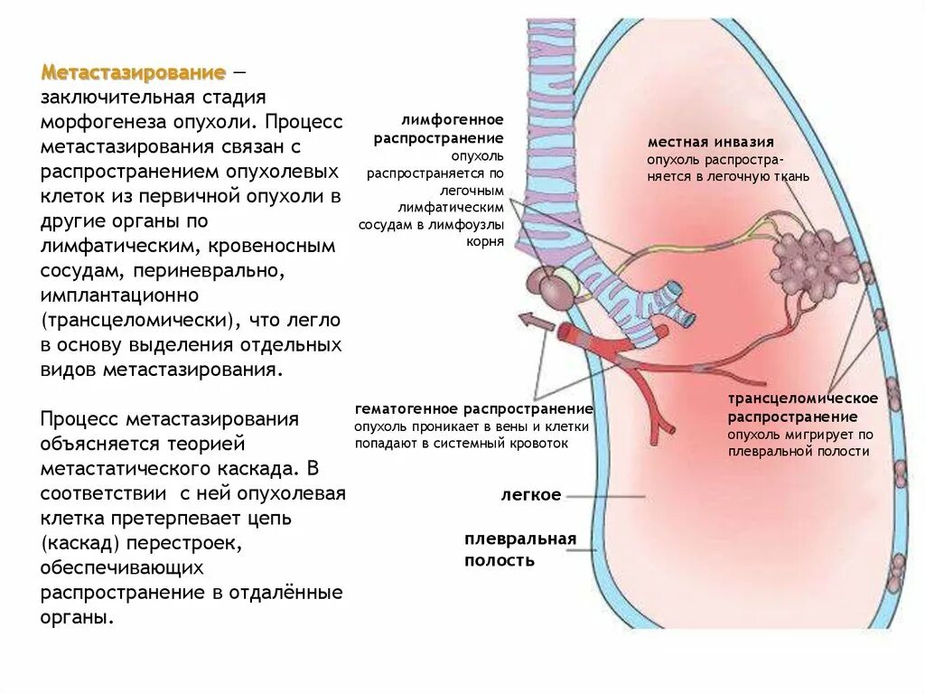 Пути метастазирования рака. Процесс метастазирования опухолей. Стадии метастазирования. Этапы метастазирования опухоли. Процесс метастазирования этапы.