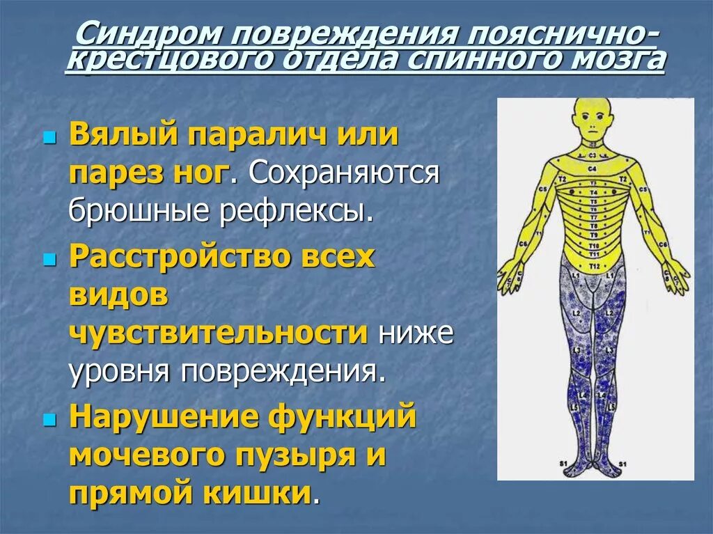 Сдавление спинного. Травмы головного и спинного мозга. Повреждение грудного отдела спинного мозга. Крестцовый отдел спинного мозга.