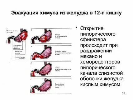 Пролабирование желудка