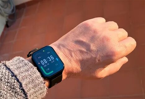 Noted xiaomi watch