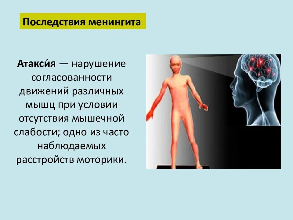 Менингит последствия у взрослых. Последствия инфекционного менингита. Осложнения при менингите.