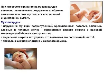 Скрининг тест новорожденных