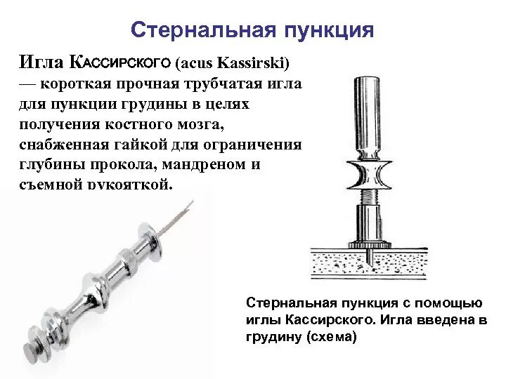 Игла Кассирского для стернальной пункции. Техника проведения стерильной пункции. Стернальная пункция методика. Подготовка пациента к стернальной пункции при лейкозе.