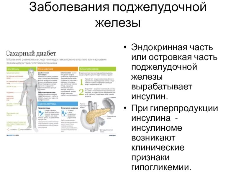 Симптомы при заболевании поджелудочной железе. Признаки поражения поджелудочной железы. Железы эндокринной части поджелудочной железы. Заболевания при нарушении поджелудочной железы. Болезни эндокринной части поджелудочной железы.