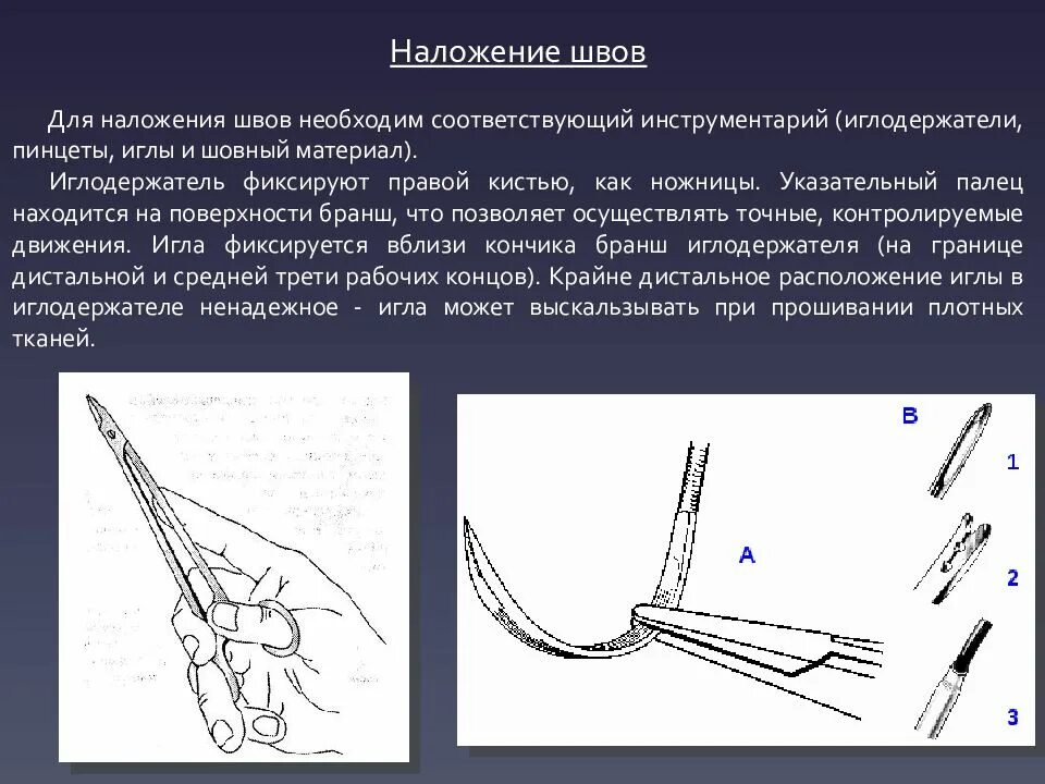 Наложение шва латынь