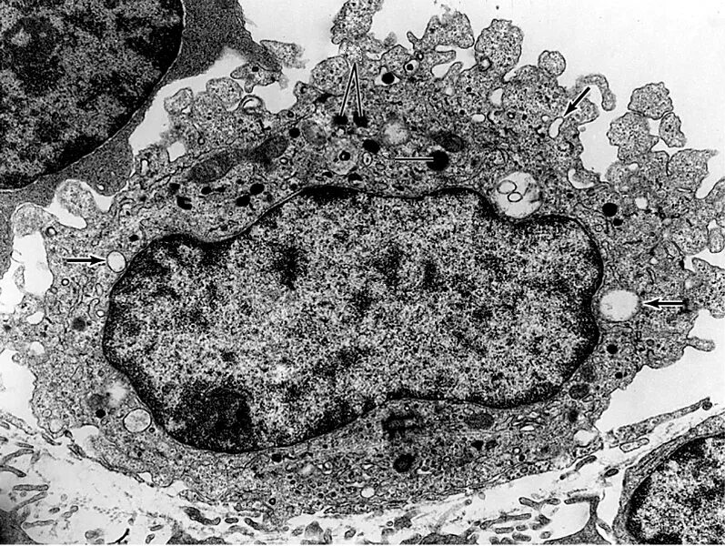 Макрофаг гистология Электронограмма. Макрофаг электронная микрофотография. Макрофаг микрофотография гистология. Лизосома электронная микрофотография. Макрофаги препарат