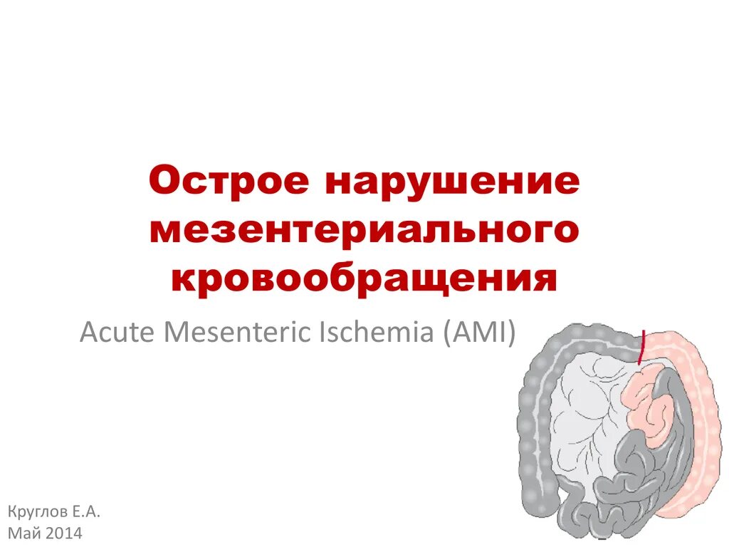 Острое мезентериальное кровообращение. Острое нарушение мезентериального кровообращения. Мезентериального кровообращения. Окклюзионные нарушения мезентериального кровообращения. Иезентеральное кровообращение.