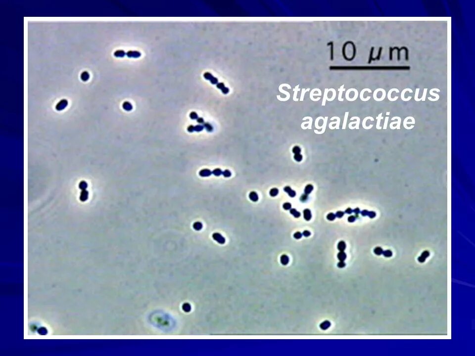 Streptococcus в мазке у мужчин. Streptococcus agalactiae в мазке. Streptococcus agalactiae микрофлора. Микроорганизмы стрептококк agalactiae.