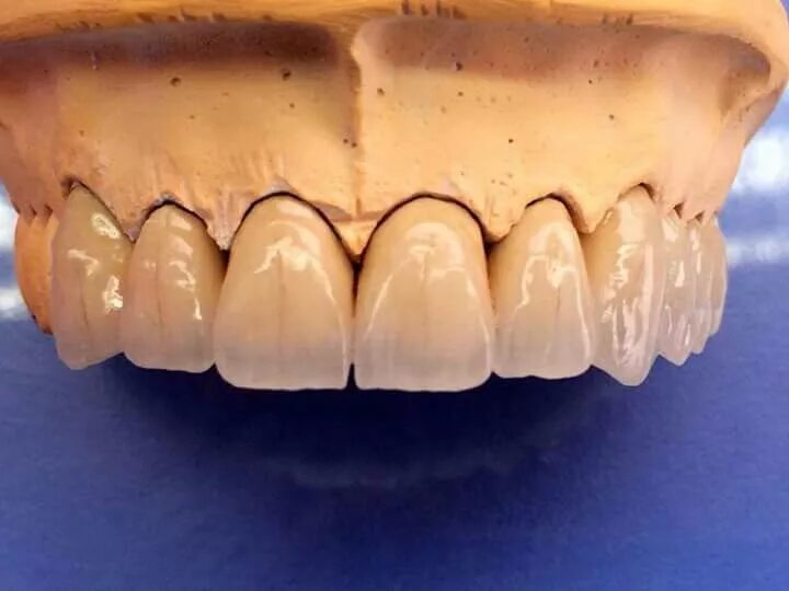 Pin on teeth