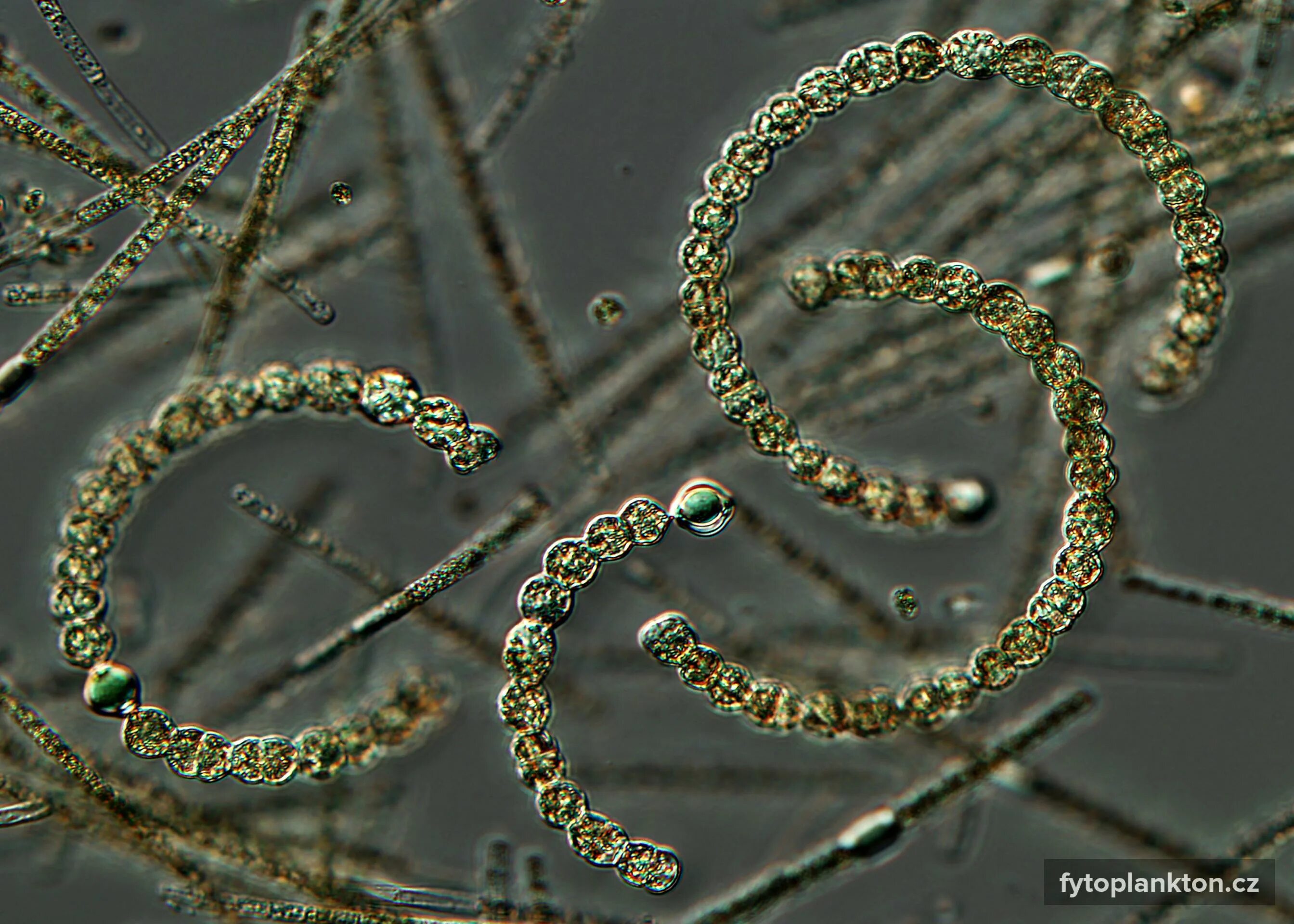 Анабена. Цианобактерия анабена. цианобактерии anabaena azollae. anabaena lemmermanii. anabaena circinalis.