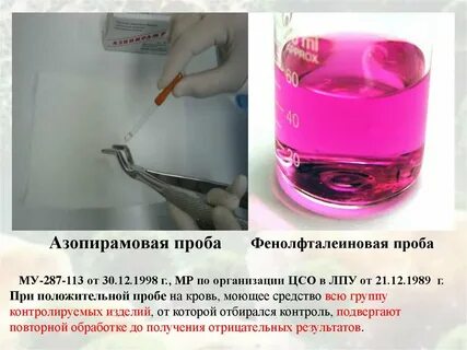 При положительной азопирамовой пробе окрашивание
