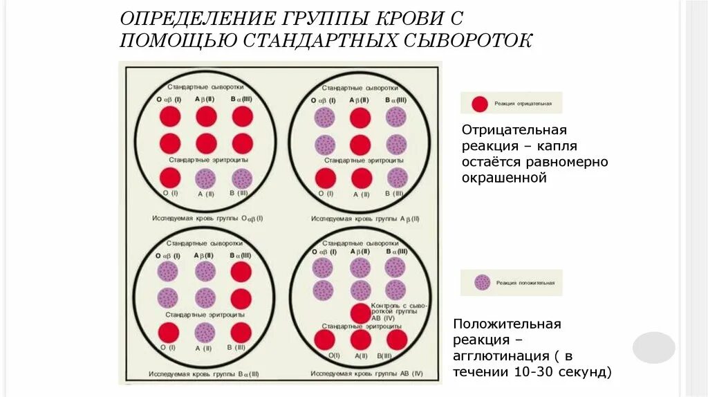 Нарисуйте схему определения группы крови по стандартным сывороткам.. Определение 2 группы крови стандартными сыворотками. Сывороточный метод определения группы крови. Метод определения крови стандартными сыворотками. Алгоритм группы крови и резус фактора