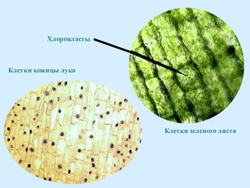 Хлоропласты в клетках эпидермиса листа.