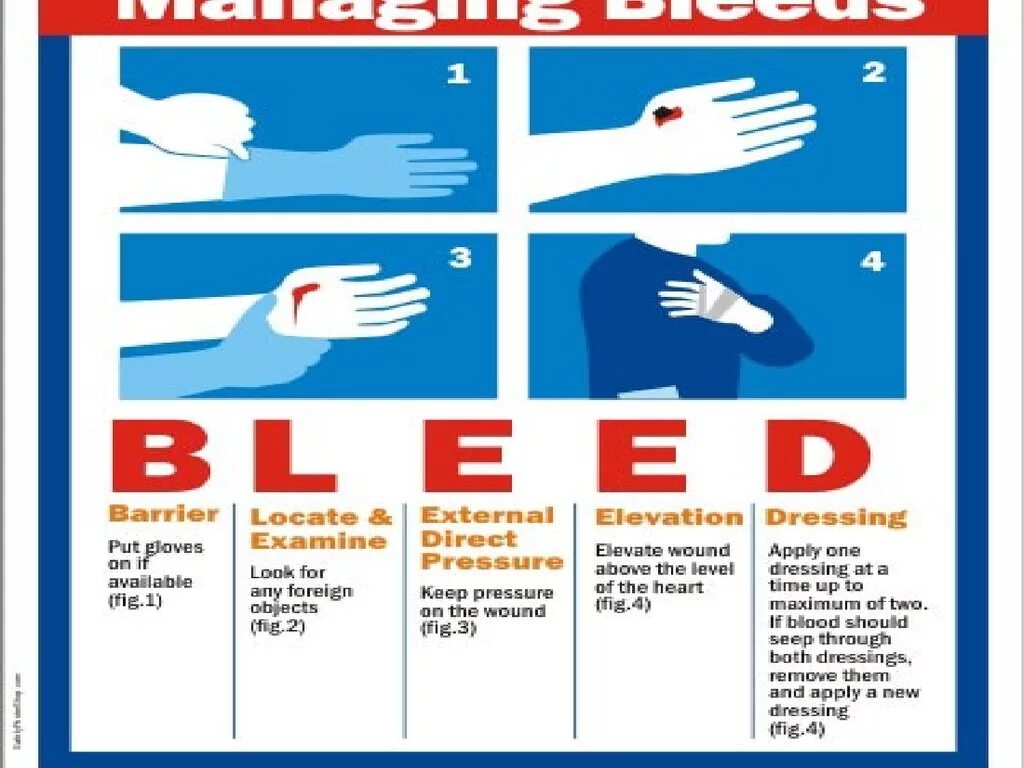 Первая помощь на английском. First Aid презентация. How to make first Aid. First Aid доклад английский.