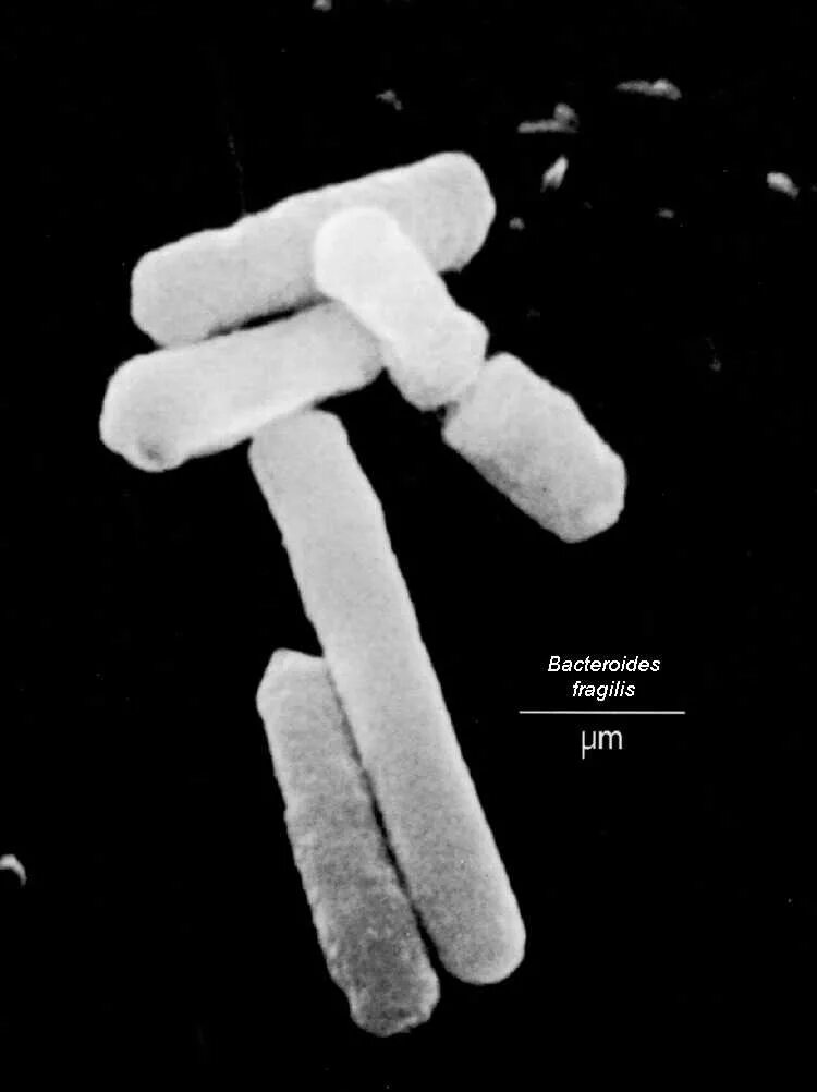Bacteroides spp что это. Бактероиды фрагилис. бактероиды фрагилис bacteroides fragilis. bacteroides fragilis микробиология. bacteroides fragilis возбудитель.