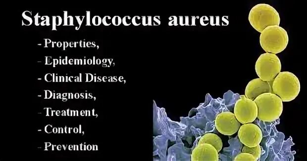 Staphylococcus e coli. Стафилококк aureus. staphylococcus aureus эпидемиология. стафилококкус ауреус.