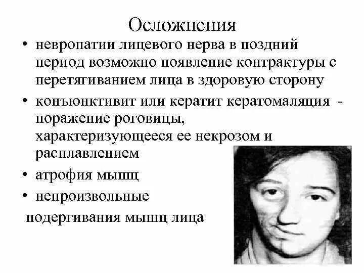 Лицевой нерв последствия. Симптомы периферического поражения лицевого нерва. Неврит лицевого нерва классификация. Неврит лицевого нерва осложнения. Осложнения при неврите лицевого нерва.