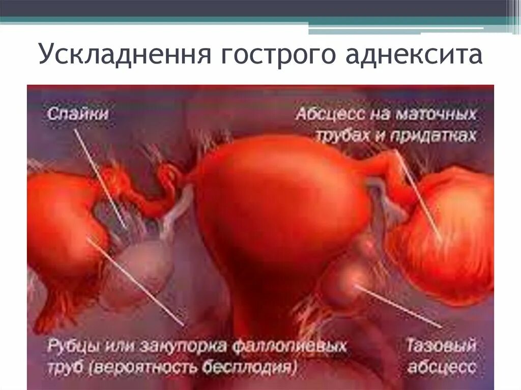 Боль в яичнике отдает в заднем проходе