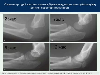 Жыныстық рентген