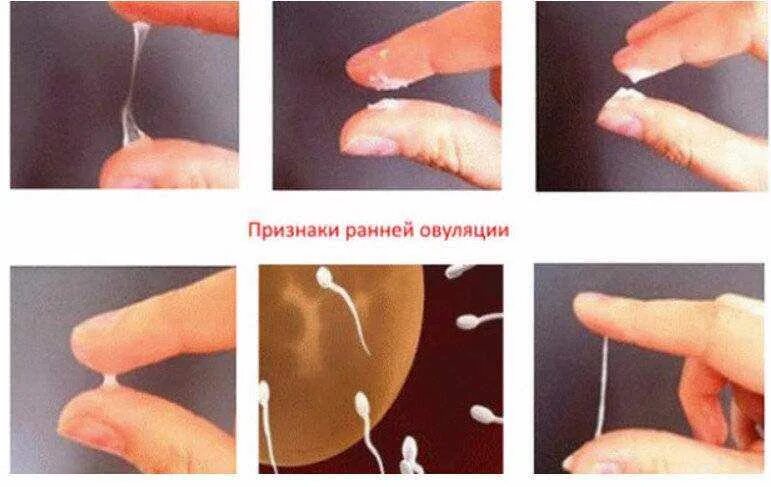 Выделения при овуляции. Выделения приовуояции. Овуляторные выделения. Женские выделения при овуляции