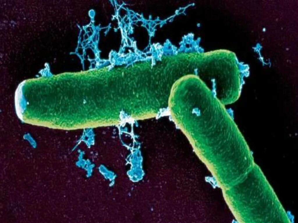 Сибирская язва возбудитель бактерия. Сибирская язва туберкулезная палочка. Bacillus oleronius.