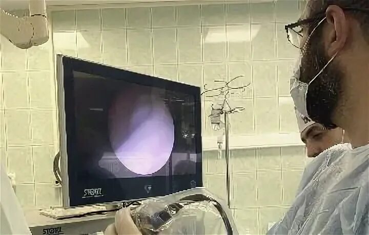 Урология видео. Урология видео