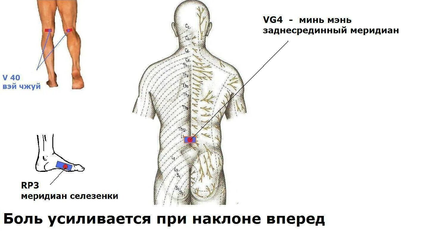 Боль в пояснице голову. Болит поясница при наклоне. Болит поясница при наклоне вперед. Боль в пояснице при наклоне. Боль при наклоне вперед.