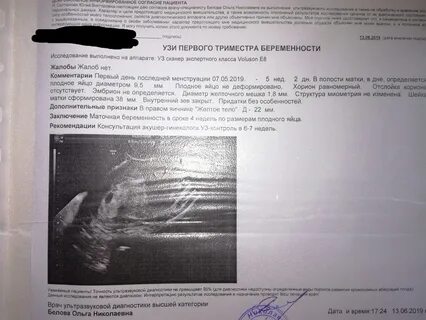 Узи точный срок беременности