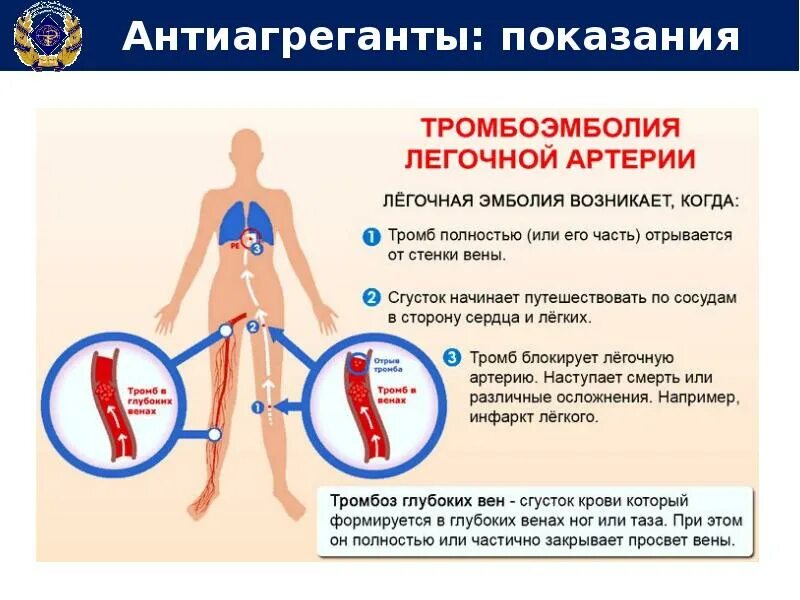 Что значит человек отрывается