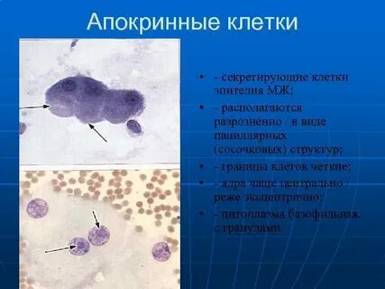 Макрофаги в молочной железе что это