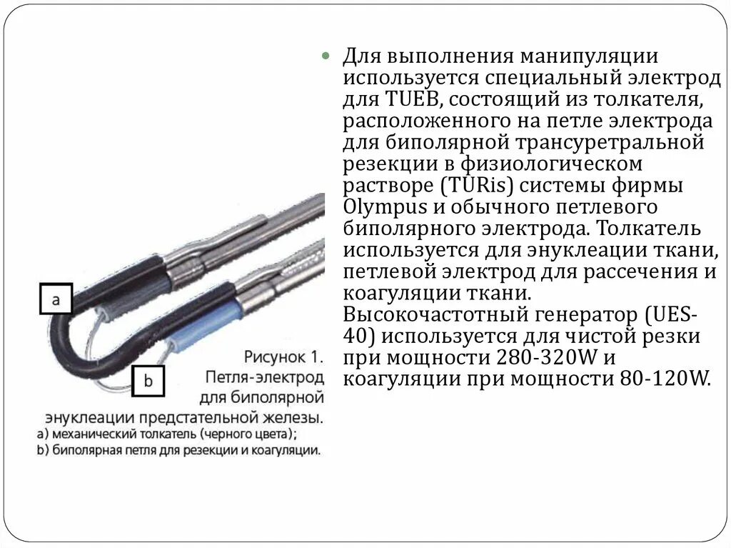 Резекция предстательной. Резекция предстательной