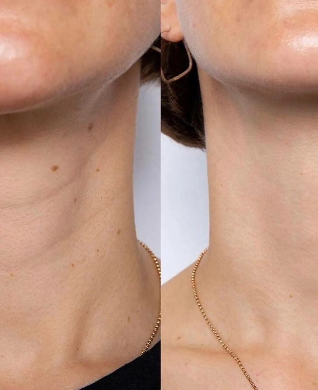 How To Remove Wrinkles From Your Neck Cheap Sale xn--h1aahyg1df.xn--p1ai
