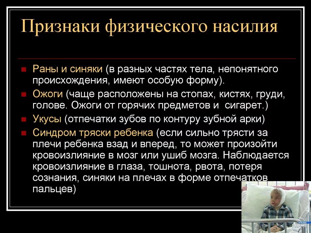 Чаще всего располагают по всему. Проявления физического насилия. Признаки физ насилия детям. Рана непонятного происхождения.