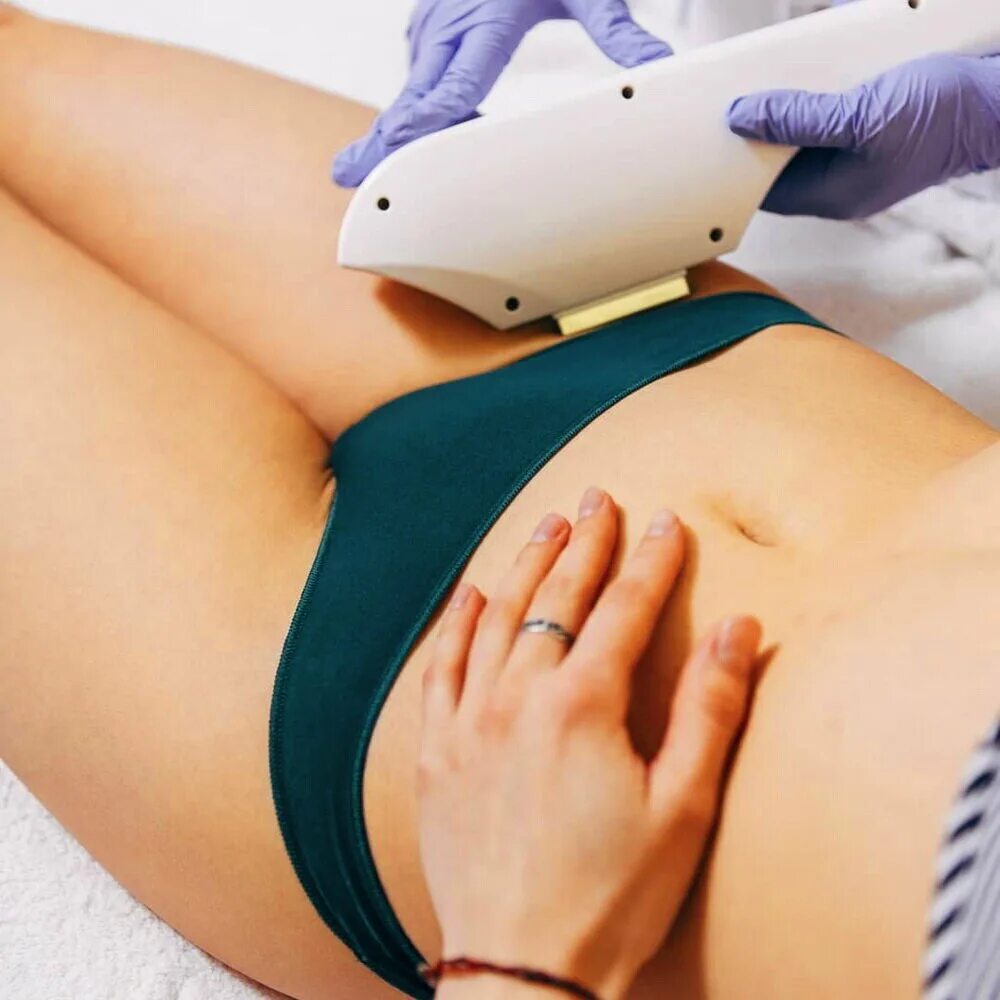 Лазерная эпиляция бикин. Фотоэпиляция глубокое бикини. Эпиляция бикини. Удаление волос лазером бикини. Лазерная эпиляция интимной зоны.