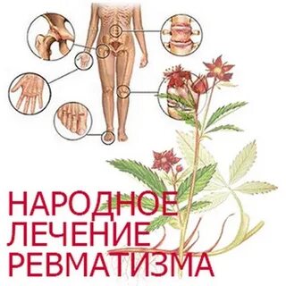Ревматизм суставов симптомы у женщин после 50