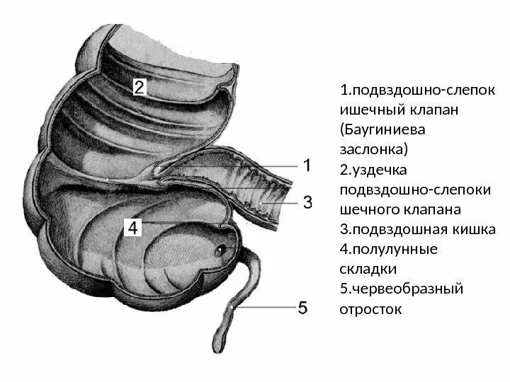 Слепая кишка форум. Баугиниевая заслонка кишечника. Илеоцекальный клапан баугиниева заслонка. Слепая кишка баугиниева заслонка. Толстая кишка илеоцекальный клапан.