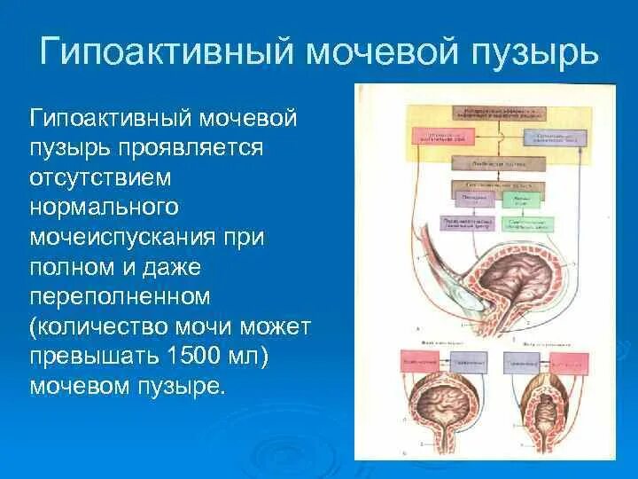 Гипоактивный мочевой пузырь. Иннервация мочевого пузыря. Гипоактивность мочевого. Гипоактивный Тип нейрогенного мочевого пузыря. Нервы мочеиспускание