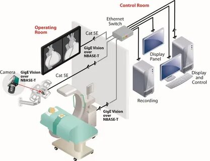 Vision systems