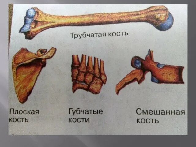 Выберите губчатую кость. Кости трубчатые губчатые плоские смешанные. Трубчатые кости и губчатые кости. Классификация костей человека. Губчатая кость человека.