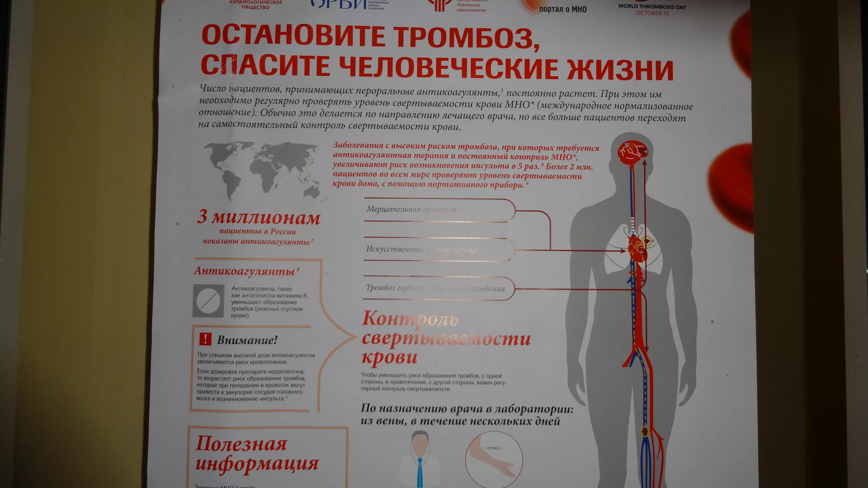 Профилактика тромбоза. Памятки по тромбофлебиту. Профилактика образования тромбов. Профилактика лечения тромбов