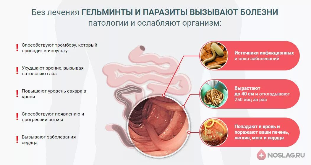 Как понять был ли организму. Заболевания вызванные гельмин. Заболевания при глистах.